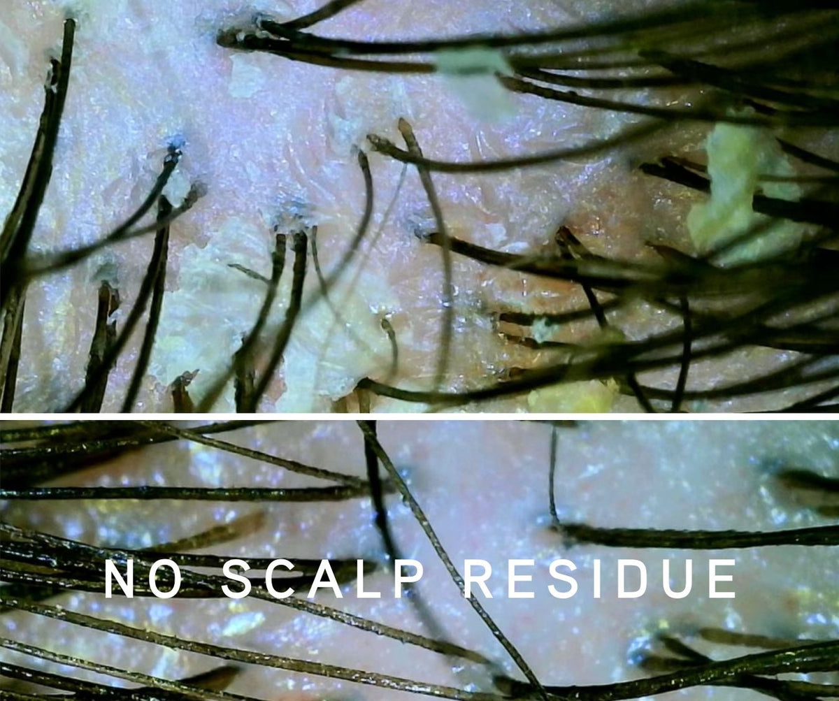 RINSELESS ROOT REFRESH